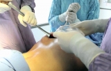 Gluteoplastia de aumento con implantes: vas de abordaje y plano de colocacin
