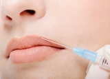 Por qu los pacientes solicitan aumento de labios