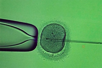 Anunciaron la creacin de embriones humanos sintticos