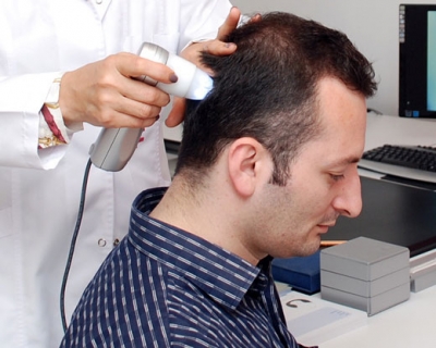 5 opciones para tratar la alopecia: mesoterapia, alta frecuencia, ultrasonido, PRP y terapias tpicas